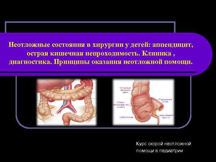 Неотложные состояния в хирургии у детей: аппендицит, острая кишечная непроходимость. Клиника , диагностика. Принципы