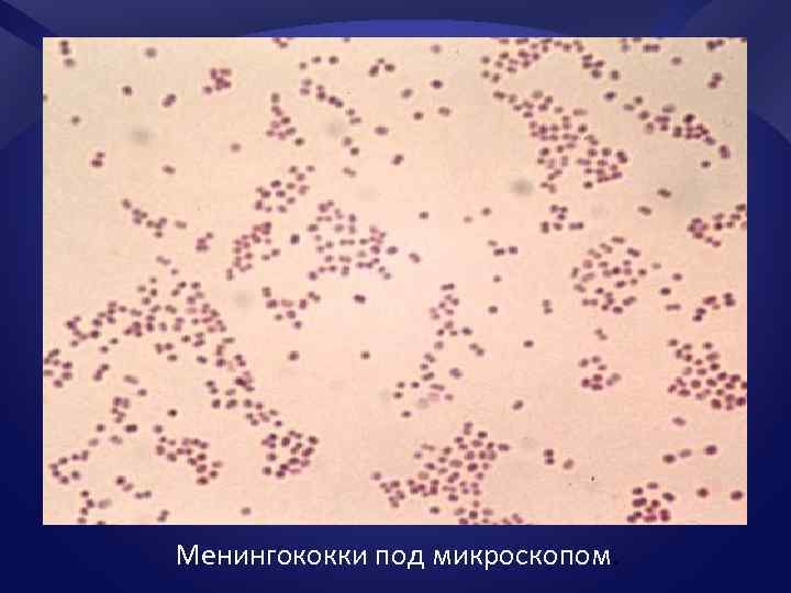 Менингококки микробиология. Менингококк микроскопия. Диплококки менингококки пневмококки гонококки. Менингококковая инфекция микроскопия. Диплококки менингококки.