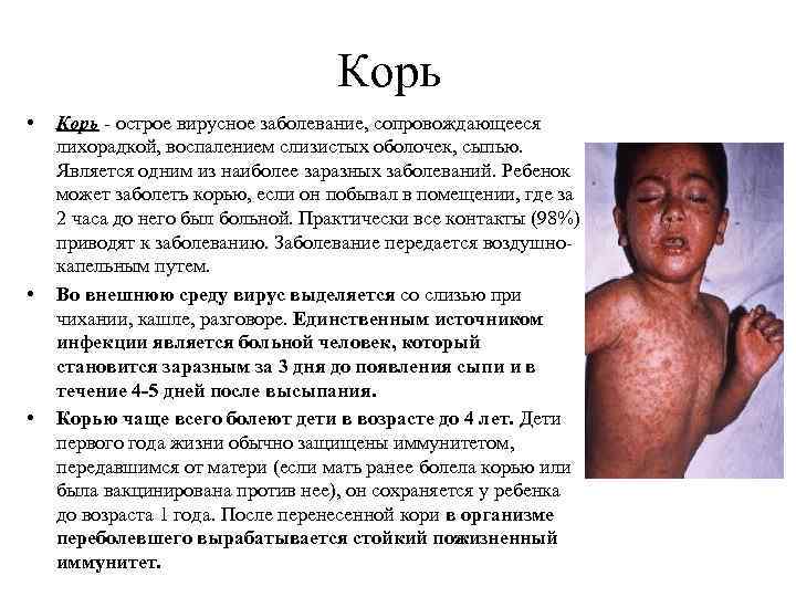 Корь • • • Корь - острое вирусное заболевание, сопровождающееся лихорадкой, воспалением слизистых оболочек,