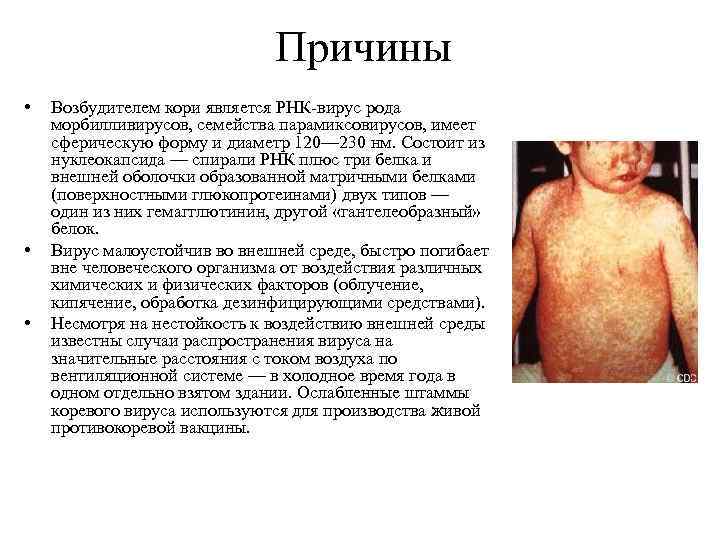 Причины • • • Возбудителем кори является РНК-вирус рода морбилливирусов, семейства парамиксовирусов, имеет сферическую