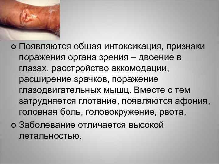 Появляются общая интоксикация, признаки поражения органа зрения – двоение в глазах, расстройство аккомодации, расширение