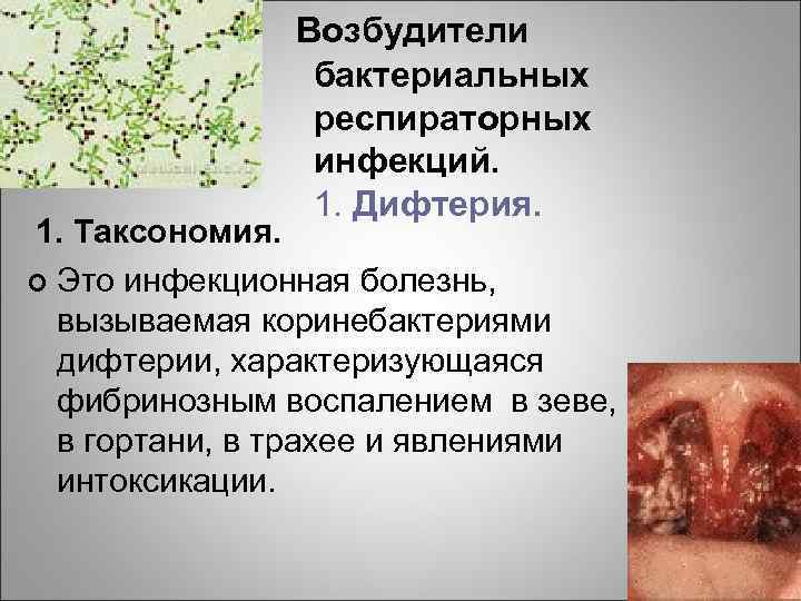 Возбудители бактериальных респираторных инфекций. 1. Дифтерия. 1. Таксономия. ¢ Это инфекционная болезнь, вызываемая коринебактериями