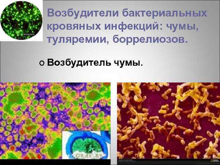Возбудители бактериальных кровяных инфекций: чумы, туляремии, боррелиозов. ¢ Возбудитель чумы. 