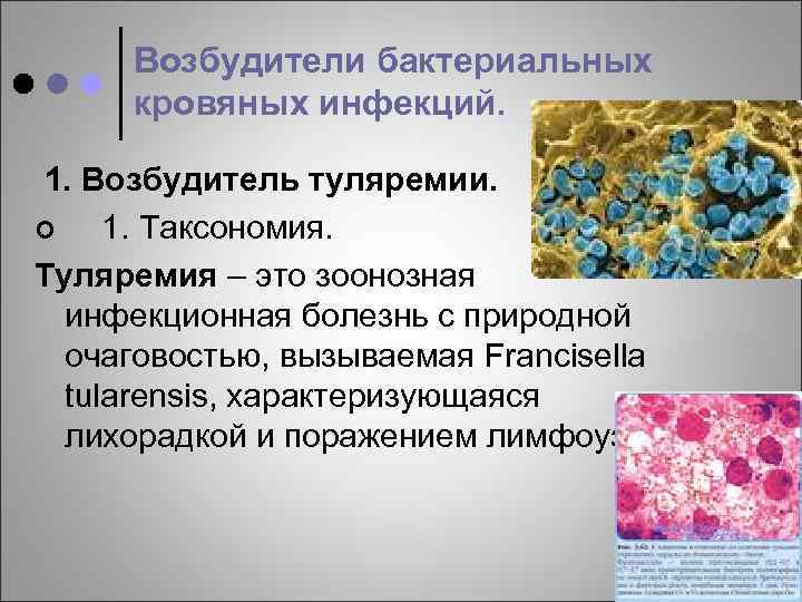 Возбудители бактериальных кровяных инфекций. 1. Возбудитель туляремии. ¢ 1. Таксономия. Туляремия – это зоонозная