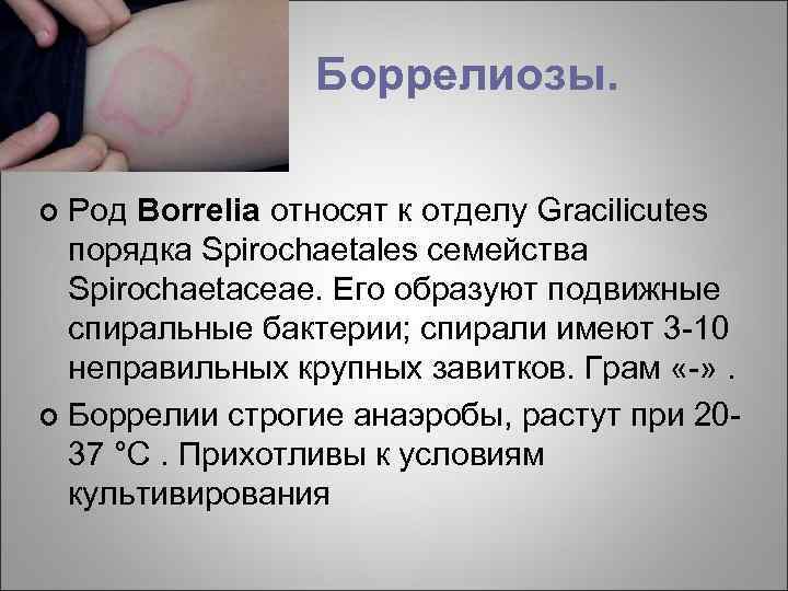 Боррелиозы. Род Borrelia относят к отделу Gracilicutes порядка Spirochaetales семейства Spirochaetaceae. Его образуют подвижные