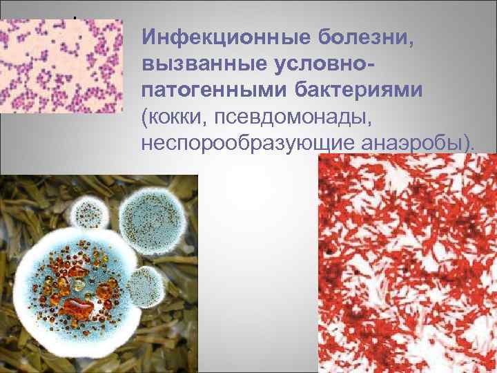 Инфекционные болезни, вызванные условнопатогенными бактериями (кокки, псевдомонады, неспорообразующие анаэробы). 
