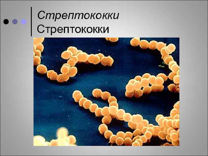 Стрептококки 