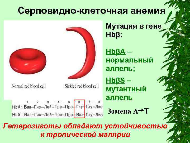 Серповидно-клеточная анемия Мутация в гене Hbβ: HbβА – нормальный аллель; HbβS – мутантный аллель