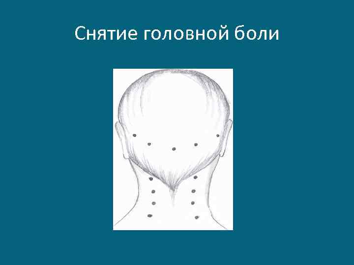 Снятие головной боли 