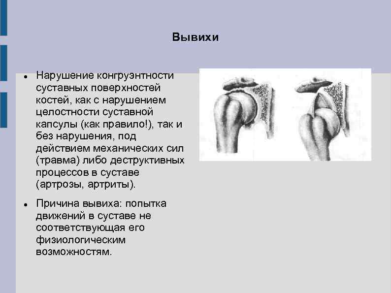 Вывих тазобедренного сустава карта вызова