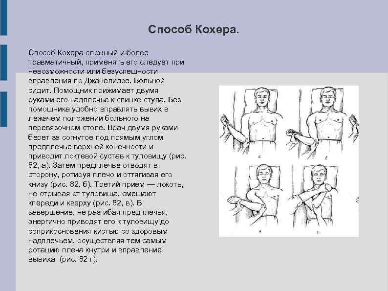 Способ Кохера сложный и более травматичный, применять его следует при невозможности или безуспешности вправления