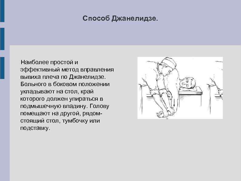 Способ Джанелидзе. Наиболее простой и эффективный метод вправления вывиха плеча по Джанелидзе. Больного в