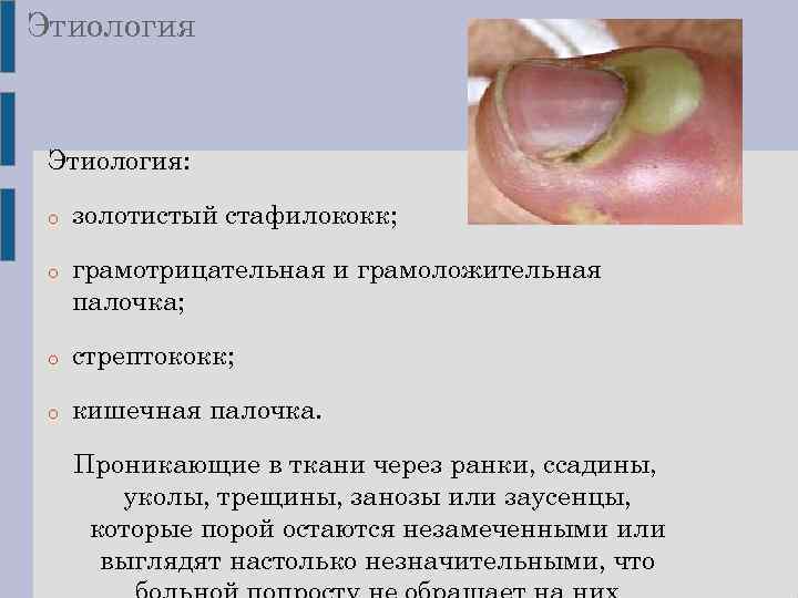 Этиология: o o золотистый стафилококк; грамотрицательная и грамоложительная палочка; o стрептококк; o кишечная палочка.