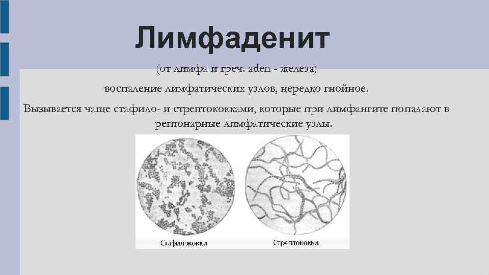 Лимфаденит карта вызова