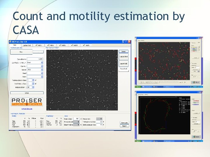 Count and motility estimation by CASA 