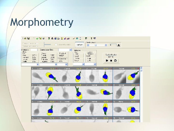 Morphometry 