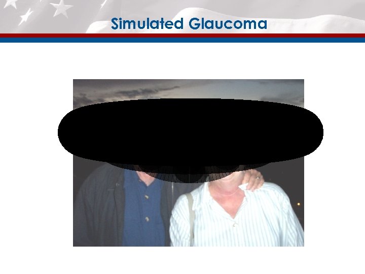 Simulated Glaucoma 