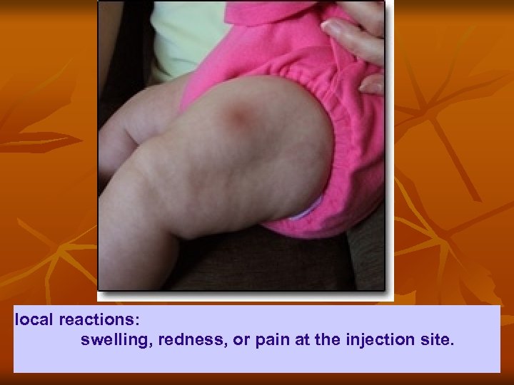 local reactions: swelling, redness, or pain at the injection site. 