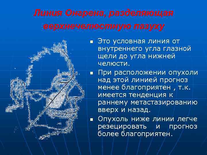 Линия Онгрена, разделяющая верхнечелюстную пазуху n n n Это условная линия от внутреннего угла