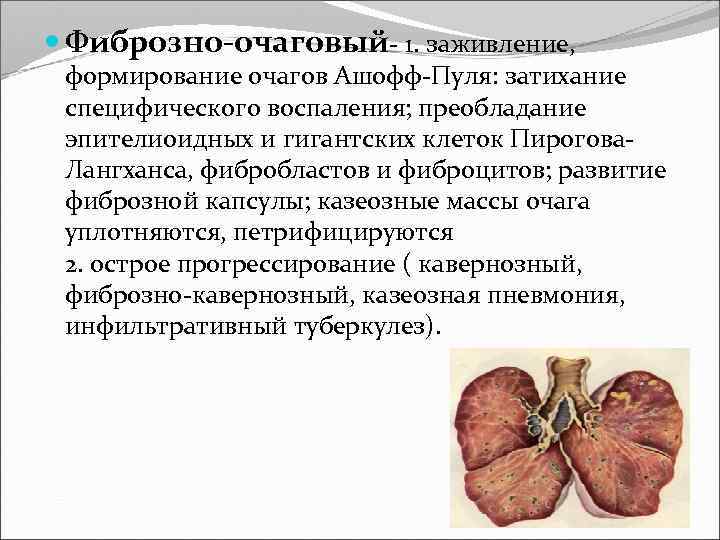  Фиброзно-очаговый 1. заживление, формирование очагов Ашофф Пуля: затихание специфического воспаления; преобладание эпителиоидных и