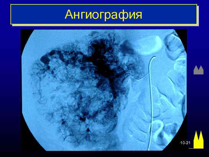 Ангиография 10 -21 