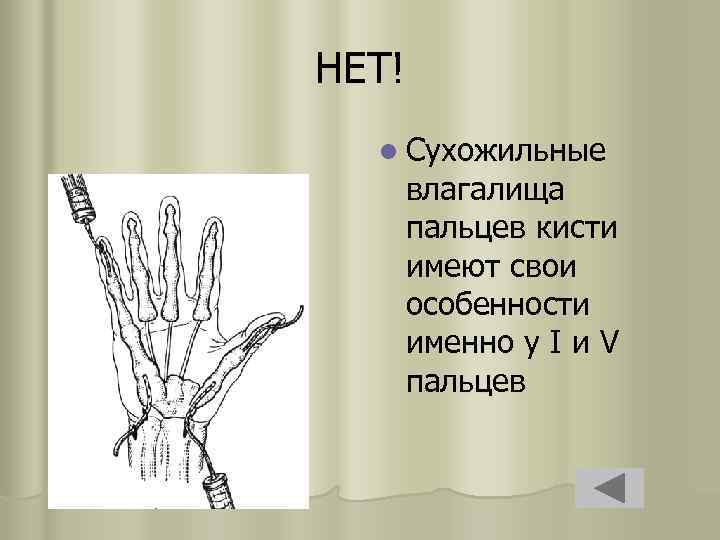 НЕТ! l Сухожильные влагалища пальцев кисти имеют свои особенности именно у I и V