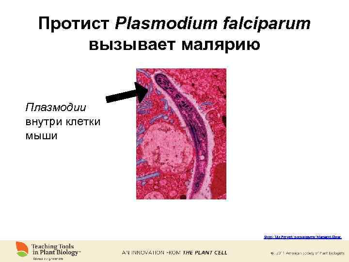 Протист Plasmodium falciparum вызывает малярию Плазмодии внутри клетки мыши Фото: Ute Frevert; псевдоцвета: Margaret