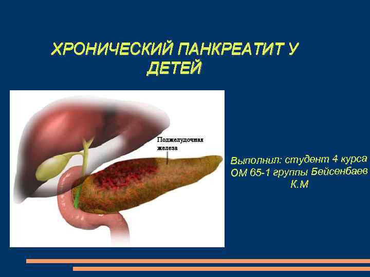 ХРОНИЧЕСКИЙ ПАНКРЕАТИТ У ДЕТЕЙ Выполнил: студент 4 курса ОМ 65 -1 группы Бейсенбаев К.