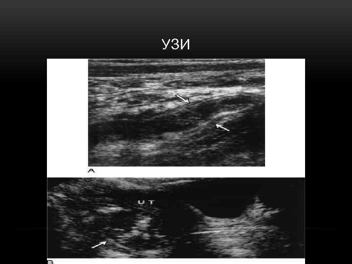 УЗИ 