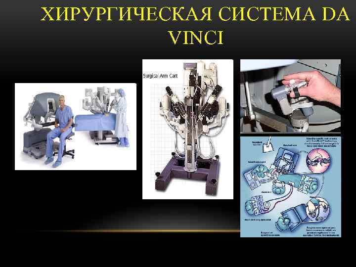 ХИРУРГИЧЕСКАЯ СИСТЕМА DA VINCI 