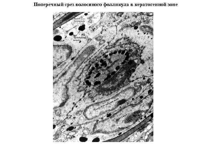 Поперечный срез волосяного фолликула в кератогенной зоне 