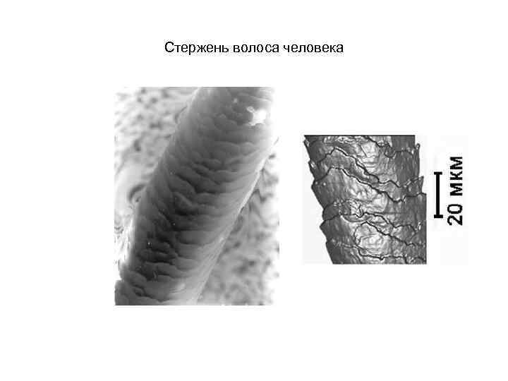 Стержень волоса человека 