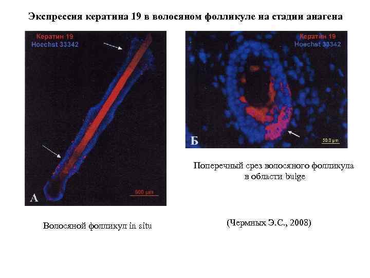 Экспрессия кератина 19 в волосяном фолликуле на стадии анагена Поперечный срез волосяного фолликула в