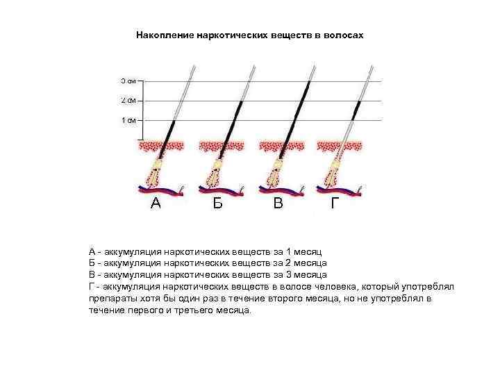 Накопление наркотических веществ в волосах А - аккумуляция наркотических веществ за 1 месяц Б