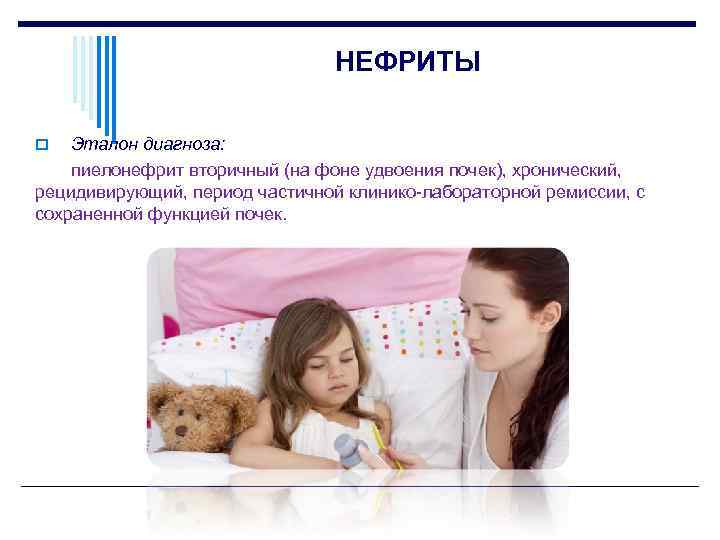 НЕФРИТЫ Эталон диагноза: пиелонефрит вторичный (на фоне удвоения почек), хронический, рецидивирующий, период частичной клинико