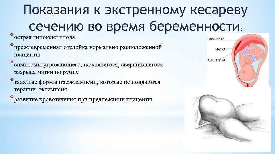 Показания к экстренному кесареву сечению во время беременности: *острая гипоксия плода *преждевременная отслойка нормально