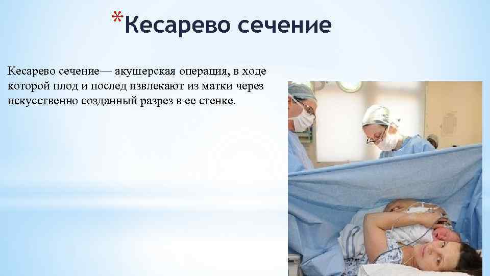 *Кесарево сечение— акушерская операция, в ходе которой плод и послед извлекают из матки через