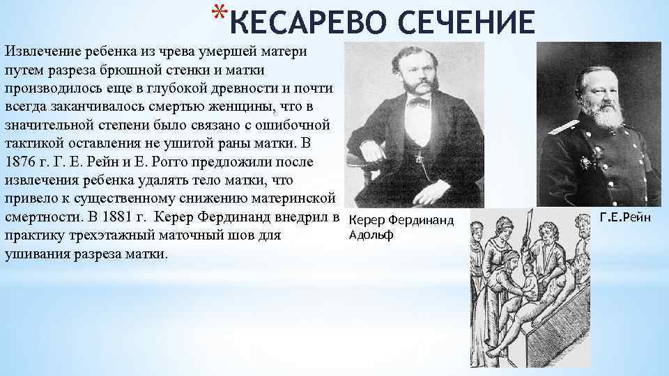*КЕСАРЕВО СЕЧЕНИЕ Извлечение ребенка из чрева умершей матери путем разреза брюшной стенки и матки