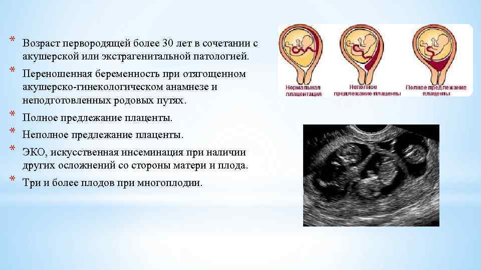 * Возраст первородящей более 30 лет в сочетании с акушерской или экстрагенитальной патологией. *