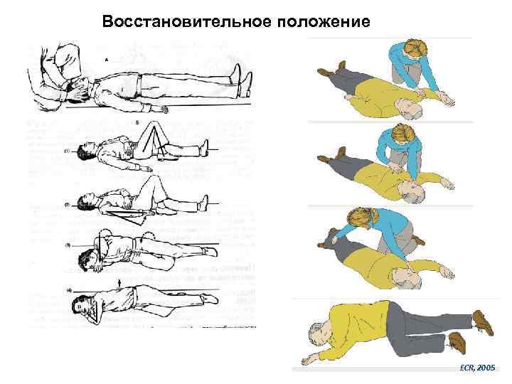 Восстановительное положение ECR, 2005 