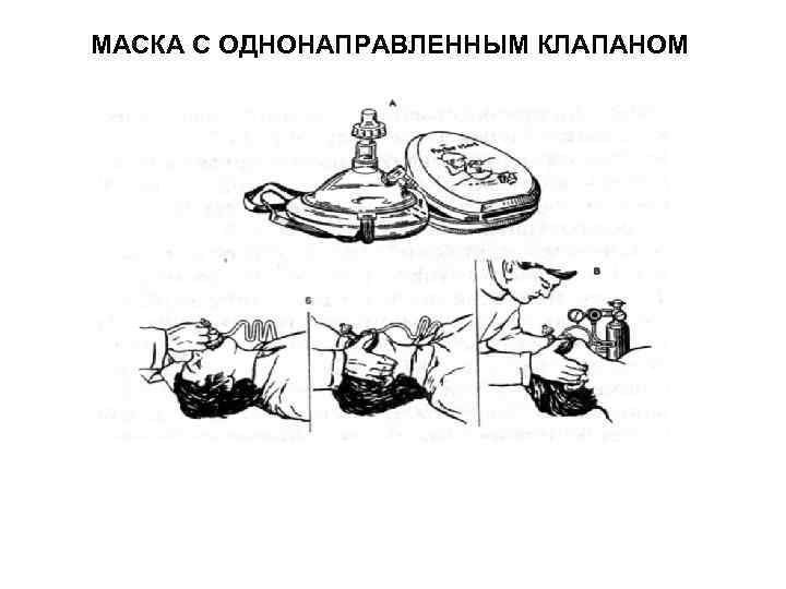 МАСКА С ОДНОНАПРАВЛЕННЫМ КЛАПАНОМ 