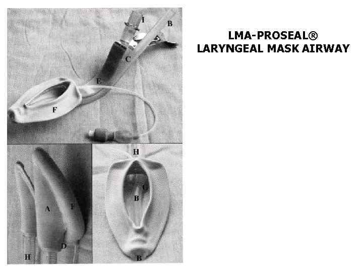 LMA-PROSEAL® LARYNGEAL MASK AIRWAY 
