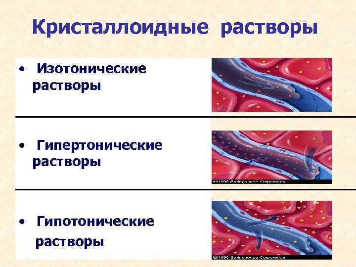 Кристаллоидные растворы • Изотонические растворы • Гипертонические растворы • Гипотонические растворы 