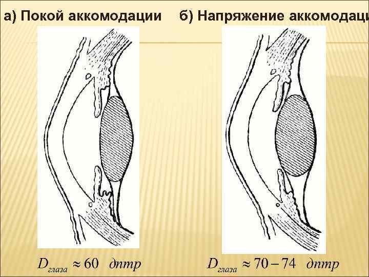 а) Покой аккомодации б) Напряжение аккомодаци 