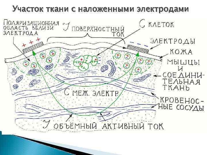 Участок ткани с наложенными электродами 