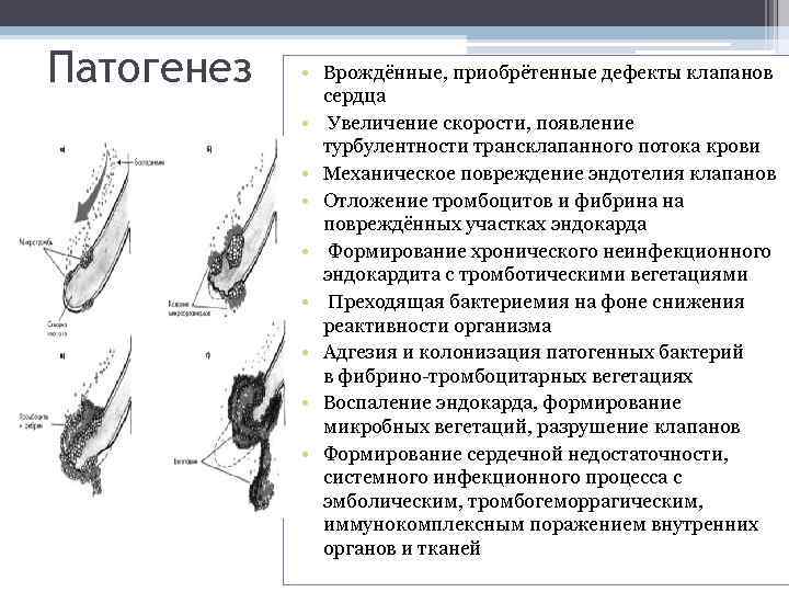 Патогенез • Врождённые, приобрётенные дефекты клапанов сердца • Увеличение скорости, появление турбулентности трансклапанного потока