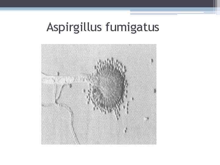 Aspirgillus fumigatus 
