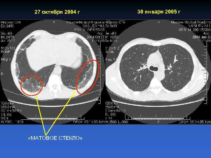 27 октября 2004 г «МАТОВОЕ СТЕКЛО» 30 января 2005 г 