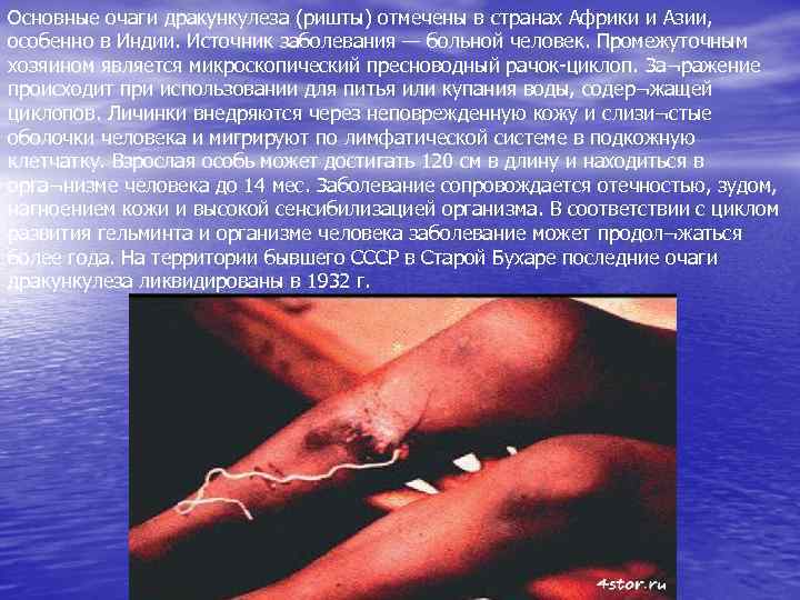 Основные очаги дракункулеза (ришты) отмечены в странах Африки и Азии, особенно в Индии. Источник