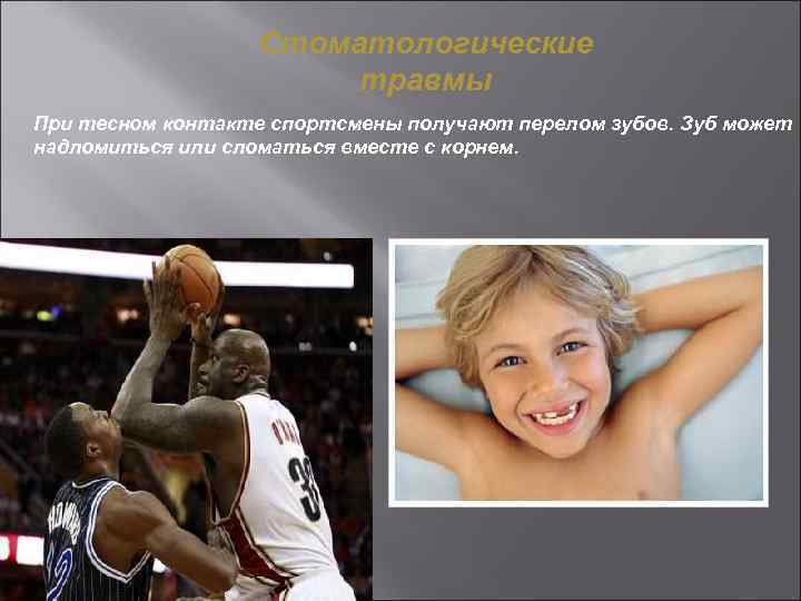 Стоматологические травмы При тесном контакте спортсмены получают перелом зубов. Зуб может надломиться или сломаться